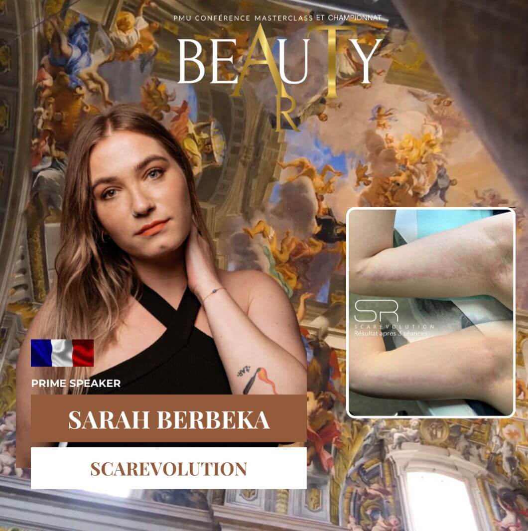 Sarah Berbeka